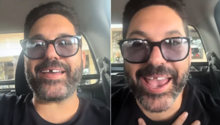 Leia mais sobre o artigo Edson, dupla de Hudson, perde dente antes de show e brinca com a situação